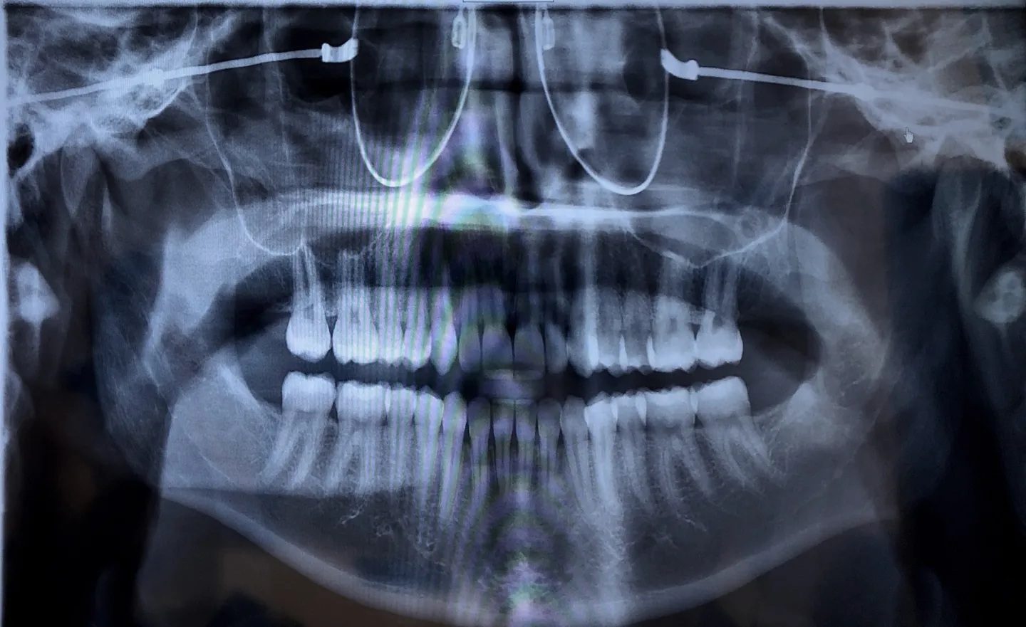 Brooklyn Review x-ray image